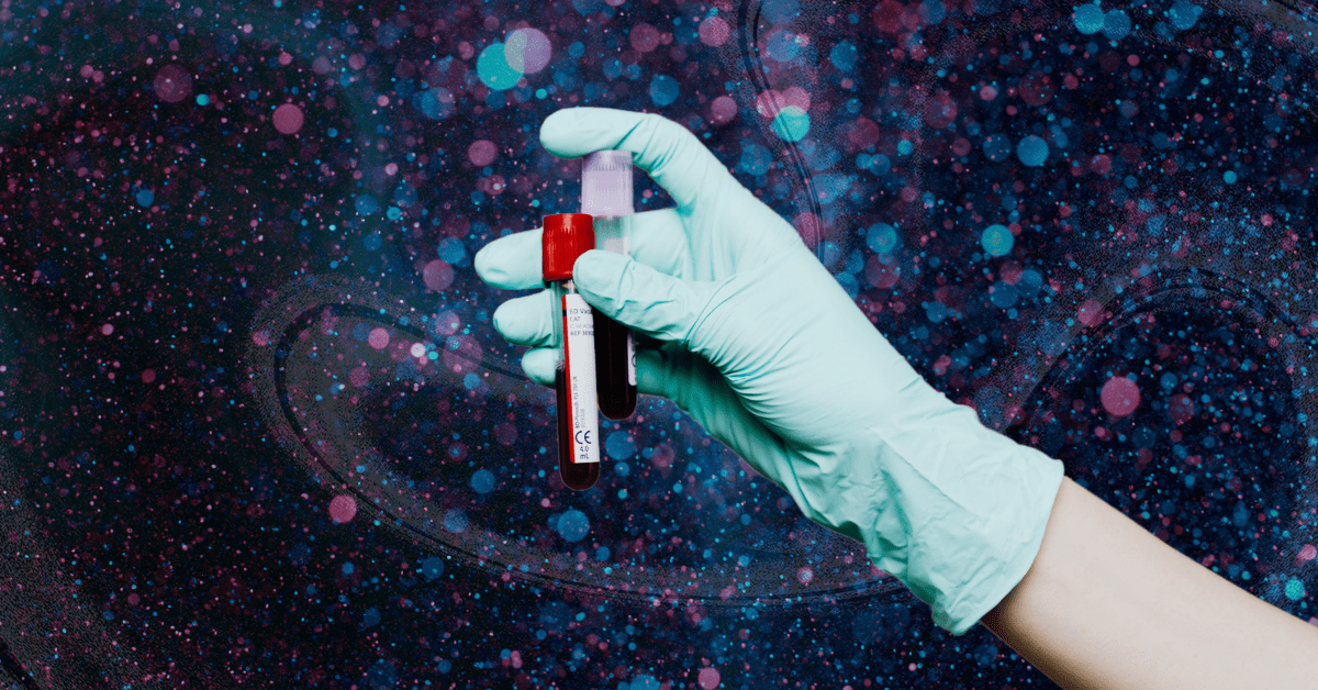 Clean blood is trendy, if you can afford it